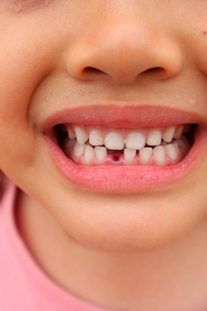 Cuts or Soft Tissue Injuries